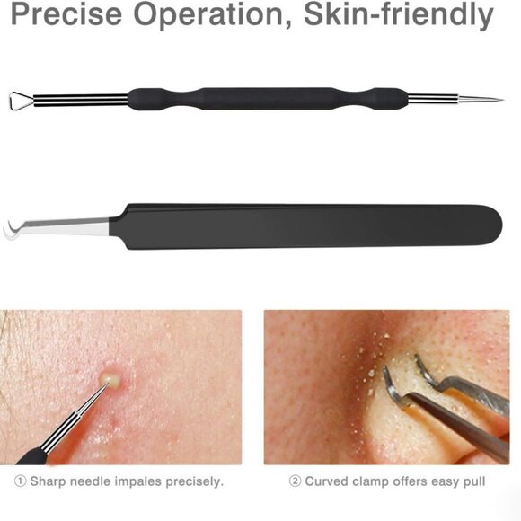 Blackhead Remover Tool Comedones Extractor Acne Removal Kit for Blemish, Whitehe - Picture 4 of 5